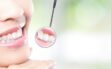 General-and-Cosmetic-Dentistry-DENTCARE-JBR