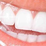 Whitening-and-Dental-Jewellery-DENTCARE-JBR